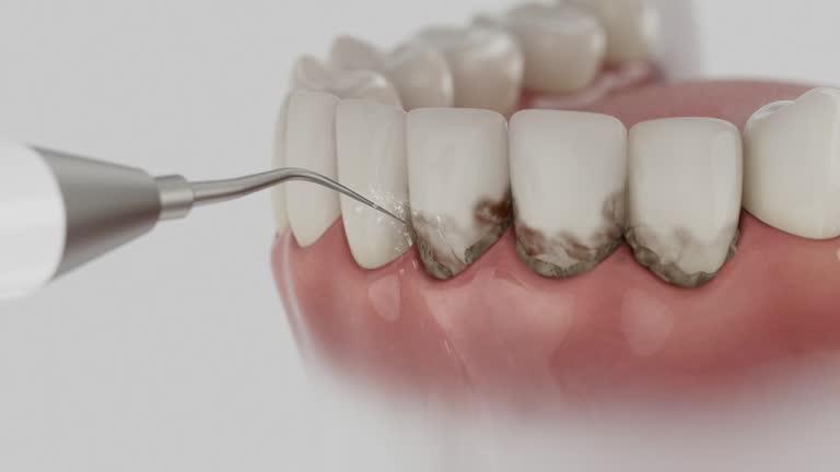 Trusted Teeth Whitening service in Springfield, MI - Dentist Open Now